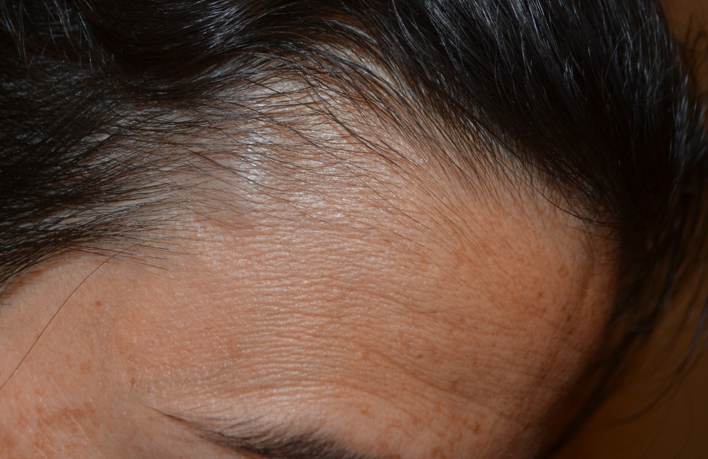 Temple Shiner